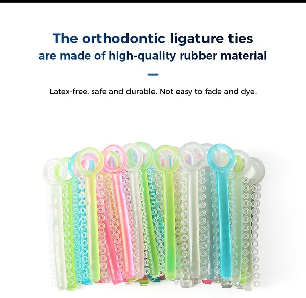 Orthodontic ligature ties 4